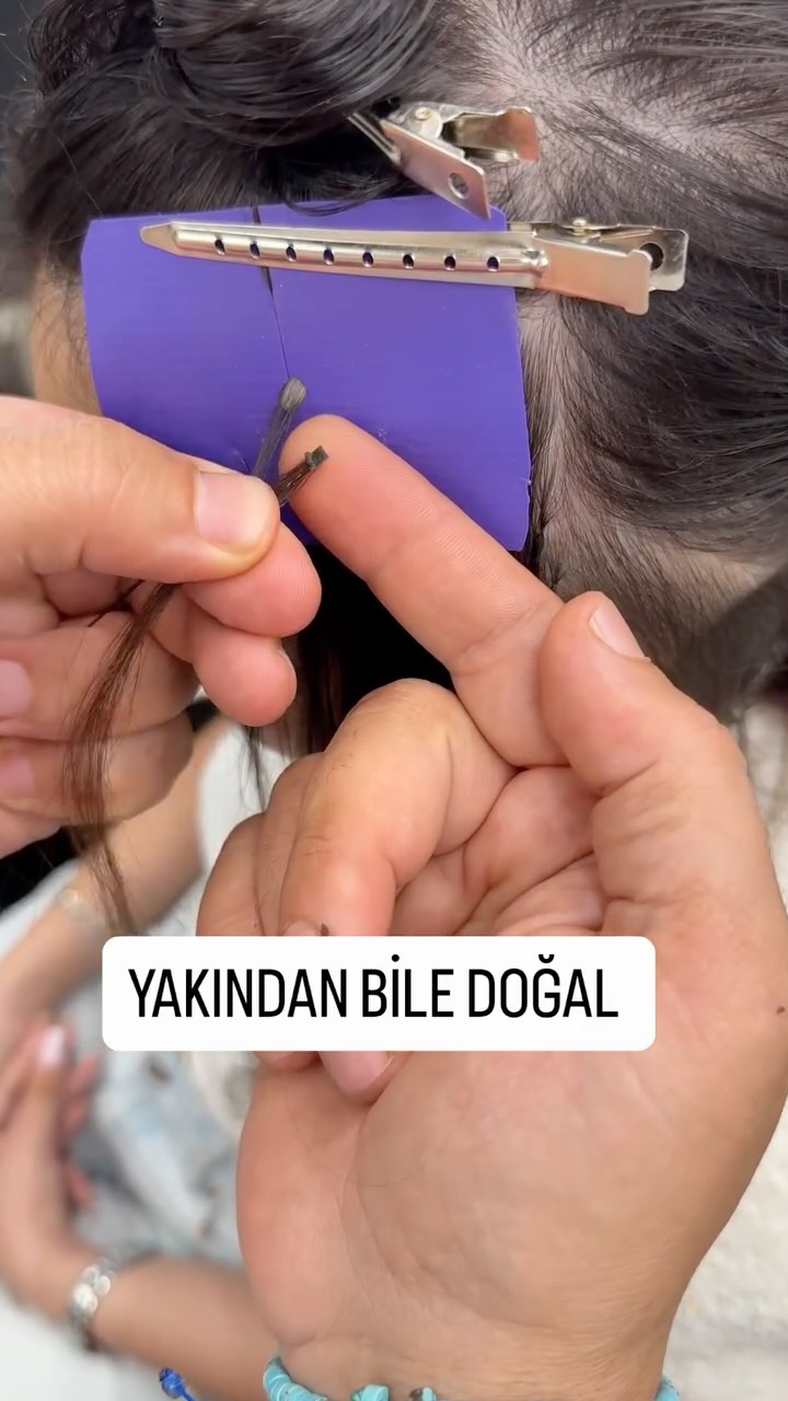 Medikal kaynak sadece takılmaz, doğru işçilikle doğal görünür.
Kişiye özel planlama • Konforlu kullanım • Profesyonel uygulama
Randevu ve detay için DM ✨
#medikalkaynak #mikrokaynak #bostanlı #izmir